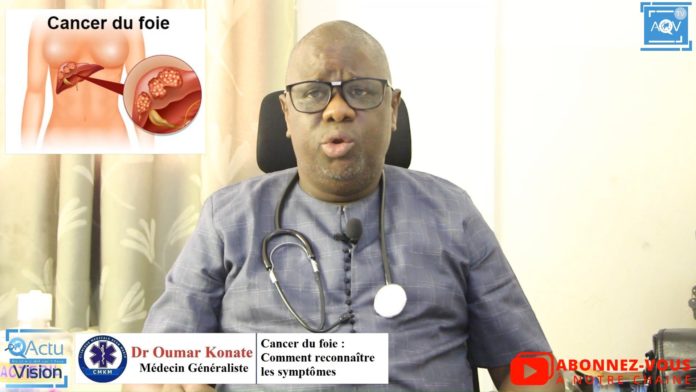 Docteur Oumar Konaté nous parle du Cancer du Foie : Comment reconnaître les symptômes