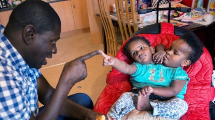 Des jumelles siamoises condamnés à vivre ensemble: Ndeye et Marième NDIAYE « cherchent » 145 millions