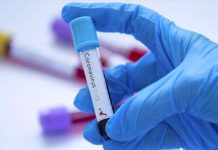 Coronavirus: 169 nouveaux cas, 5 décès supplémentaires et 28 cas graves