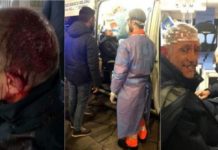 Italie – Folie dans un métro : Un Sénégalais envoie 4 personnes à l’hôpital