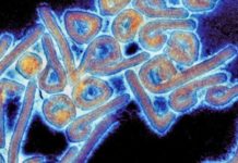 Maladie à virus de Marburg: Un premier cas confirmé en Guinée