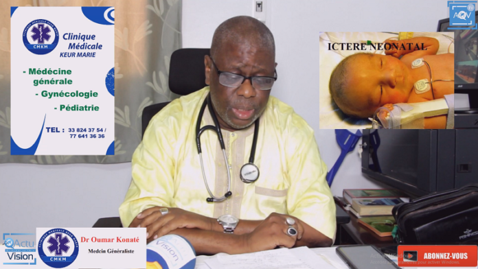 Docteur Oumar Konaté nous parle d'une maladie rare nommé : Ictère Néonatal, manifestations et traitements...