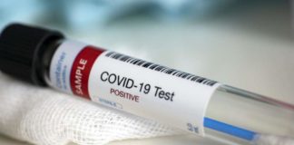 Covid-19, Point du Jour: 30 nouveaux cas dont 11 communautaires,1 décès, 36 cas graves, 3663 patients sous traitement