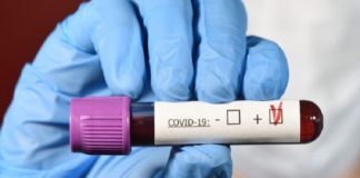 Covid-19, Point du Jour: 43 nouveaux cas dont 17 communautaires, 4 cas importés, 34 cas graves, 3549 patients sous traitement