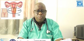 Docteur Oumar Konaté nous parle du Cancer du Col de l'Utérus de ses causes et conséquences