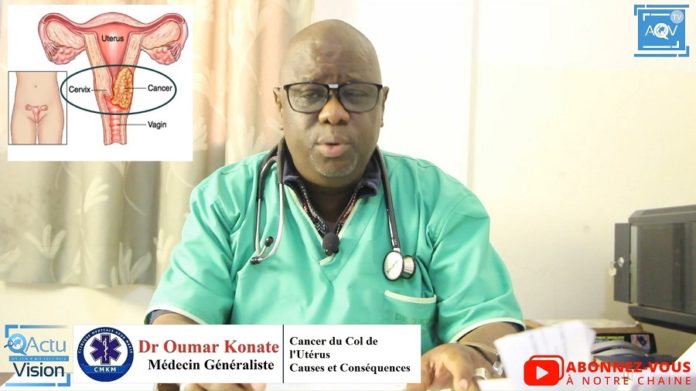 Docteur Oumar Konaté nous parle du Cancer du Col de l'Utérus de ses causes et conséquences