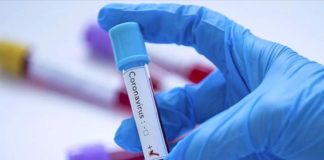 Covid-19, Point du Jour : 14 nouveaux cas et 2 décès supplémentaires