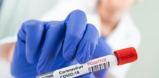 Covid-19, Point du Jour: 24 nouveaux cas, 0 décès, 52 guéris