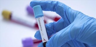 Covid-19, Point du Jour: 1 décès supplémentaire et 25 nouveaux cas...