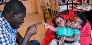 Des jumelles siamoises condamnés à vivre ensemble: Ndeye et Marième NDIAYE « cherchent » 145 millions
