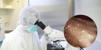 Maladie "Mystérieuse": Ce qu'indiquent les premiers résultats des tests!