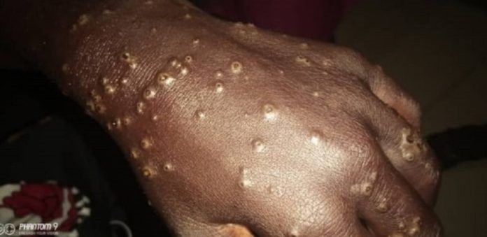 Maladie dermatologique : la marine mène des investigations en haute mer