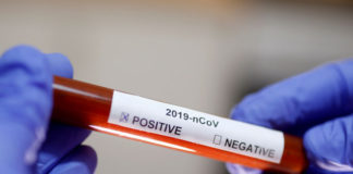 Covid-19 : 07 décès, 373 cas positifs et 53 cas graves, ce vendredi 5 février (Vidéo)